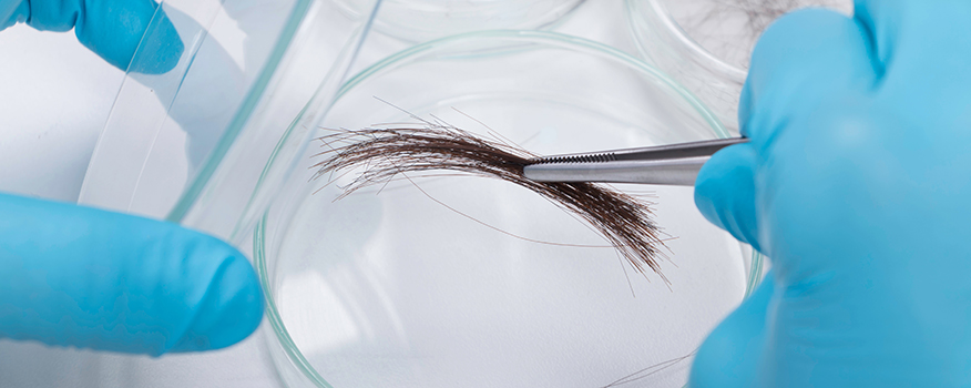 Hair Tissue Mineral Testing Clearwater