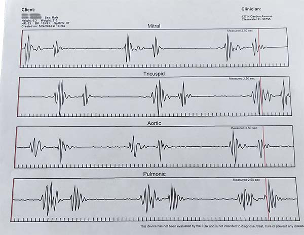 Heart Recorder Graph