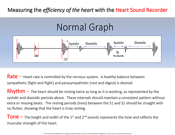 Heart Recorded Graph Clearwater