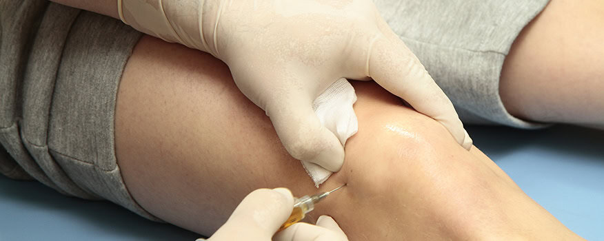 Joint Injections Clearwater