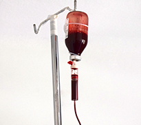 Ozone Therapy Clearwater