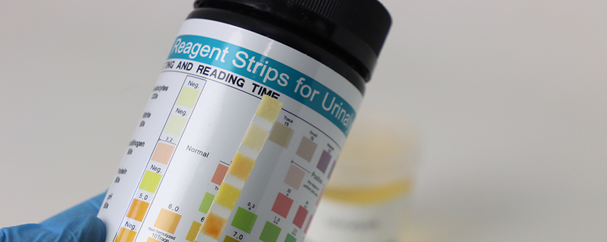 Urinalysis Clearwater